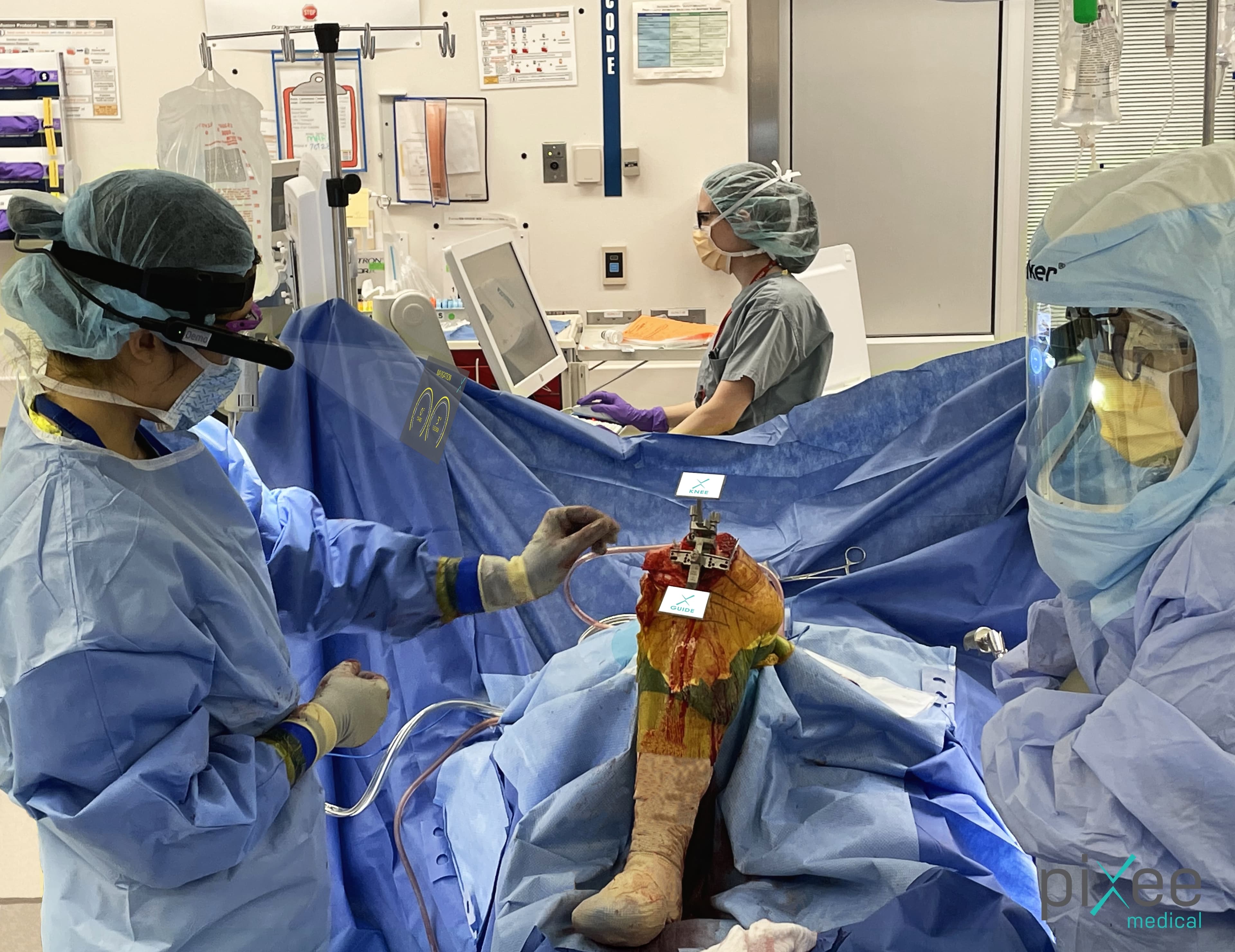 Knee Replacement Surgery in the USA: A Guide to Surgeons, Hospitals, Rehabilitation, and Treatment Considerations